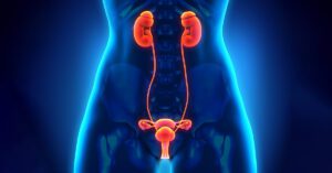 Posterior Urethral Valves (PUV) in Male Infants