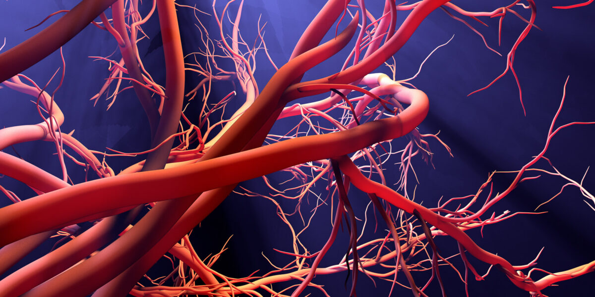 Vascular Erectile Dysfunction